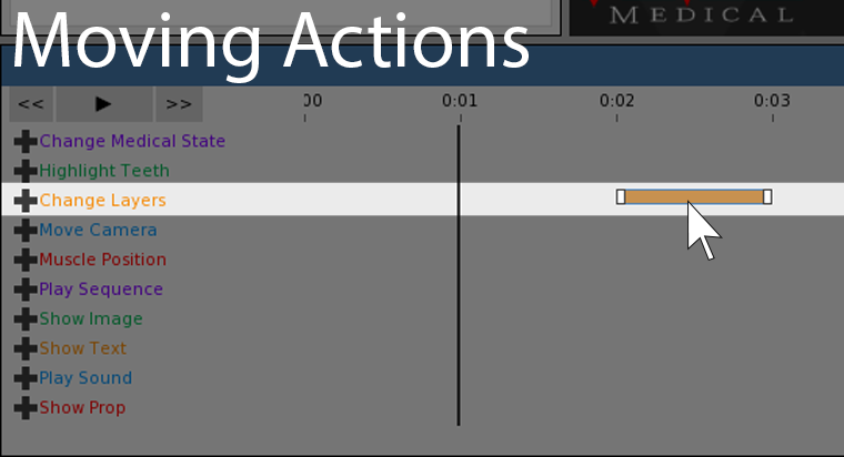 This screenshot shows the timeline actions.