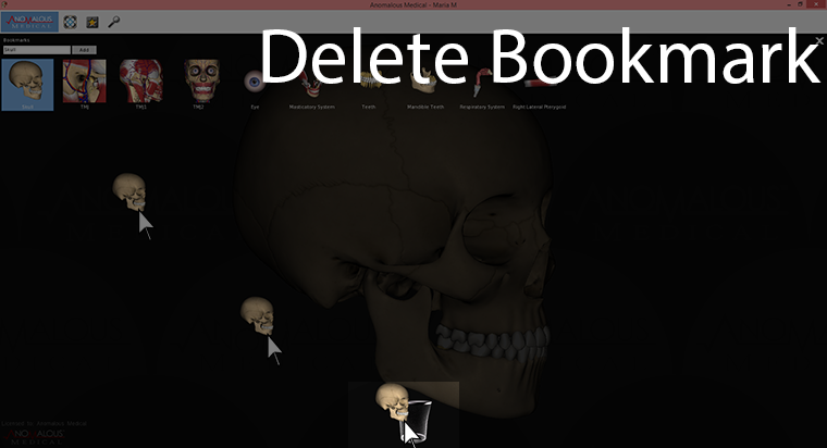This screenshot shows deleting a bookmark.