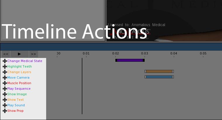 This screenshot shows the timeline actions.