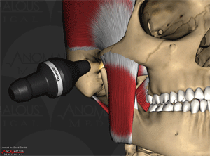 Doppler Diagnosis using 3D medical simulation software